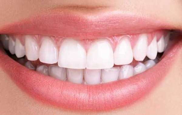 WHAT IS THE PROCEDURE OF TEETH WHITENING