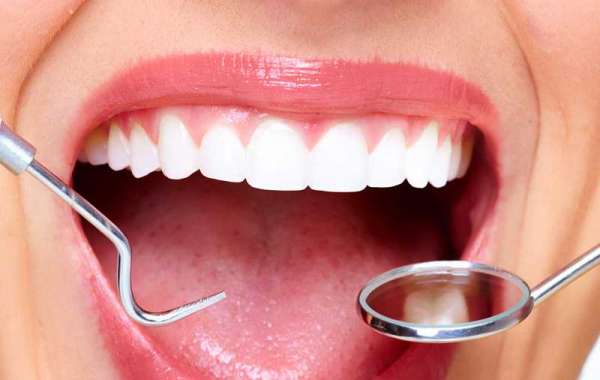 Why Dental Bonding Resin