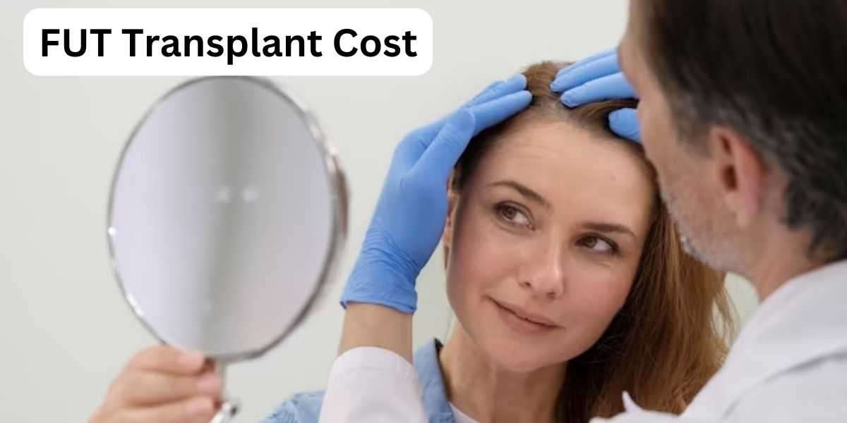 How Much Does FUT Transplant Cost at Beverly Hills Hair Restoration