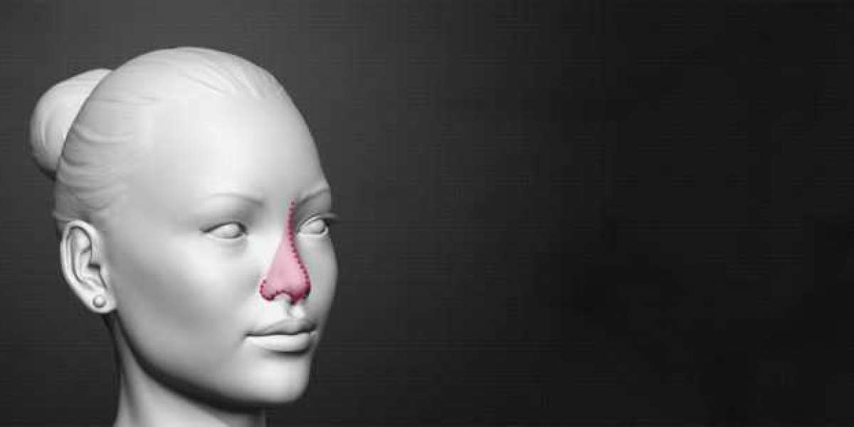 The Role of Nasal Feminization Rhinoplasty in Transgender Surgery