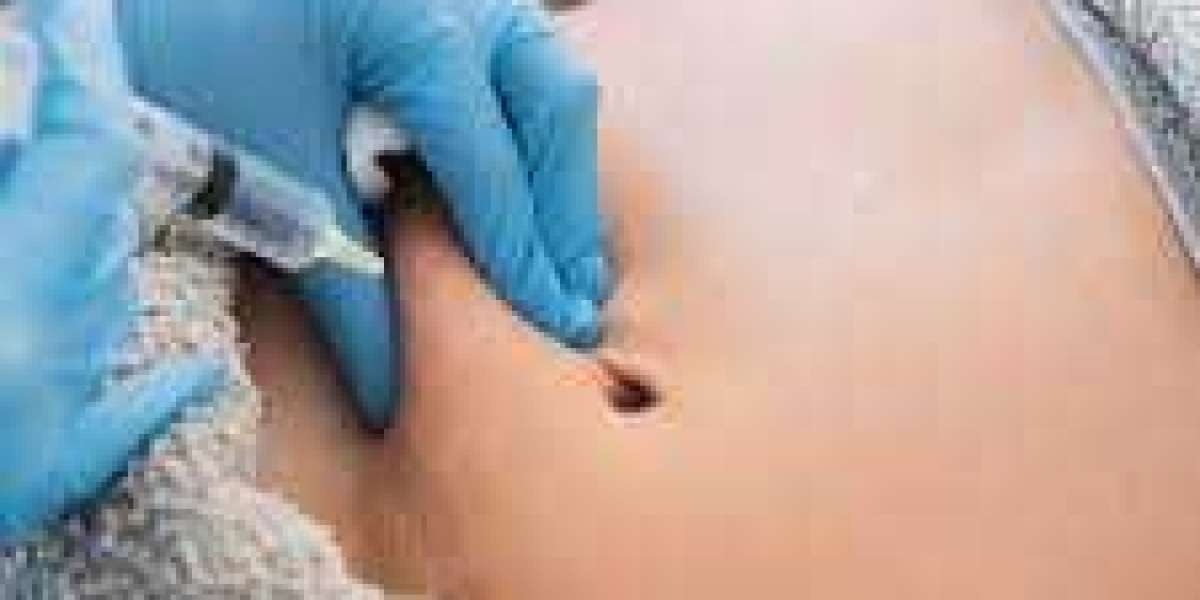 Sculpt Your Body: The Benefits of Fat Dissolving Injections in Islamabad