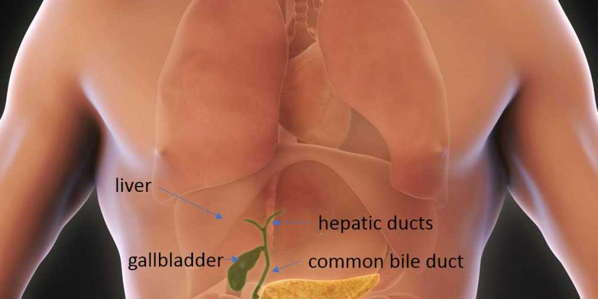 Faster Recovery, Less Pain: Why Laparoscopic Surgery Is the Best Choice in Riyadh